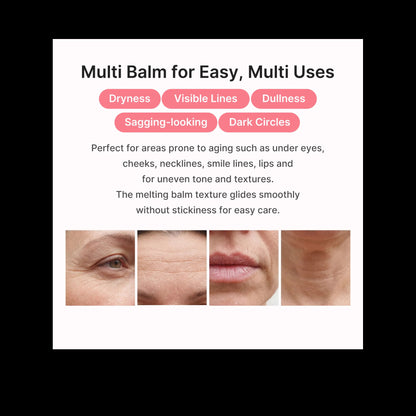 [NEW] [Medicube] PDRN Pink Collagen Volume Multi Balm | All in One Volufiline, PDRN, NAD Stick for Youthful-Looking, Helping Look of Fine Lines, Firming Care, Anti-Aging Care | for Under-Eyes, Neck, Forehead, Smile Lines, Lip Care | Korean Skincare